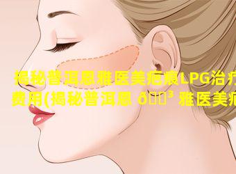 揭秘普洱恩雅医美疤痕LPG治疗费用(揭秘普洱恩 🌳 雅医美疤痕lpg治疗费用)